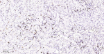 MCM2 Antibody in Immunohistochemistry (Paraffin) (IHC (P))