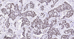 MCM2 Antibody in Immunohistochemistry (Paraffin) (IHC (P))