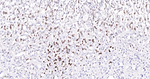 MCM2 Antibody in Immunohistochemistry (Paraffin) (IHC (P))