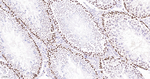 MCM2 Antibody in Immunohistochemistry (Paraffin) (IHC (P))