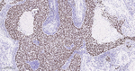 MCM2 Antibody in Immunohistochemistry (Paraffin) (IHC (P))