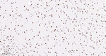 Phospho-p38 MAPK (Thr180) Antibody in Immunohistochemistry (Paraffin) (IHC (P))