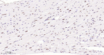 Phospho-p38 MAPK (Thr180) Antibody in Immunohistochemistry (Paraffin) (IHC (P))