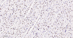 Phospho-p38 MAPK (Thr180) Antibody in Immunohistochemistry (Paraffin) (IHC (P))
