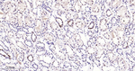 Phospho-p38 MAPK (Thr180) Antibody in Immunohistochemistry (Paraffin) (IHC (P))