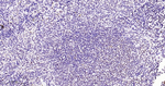 Phospho-p38 MAPK (Thr180) Antibody in Immunohistochemistry (Paraffin) (IHC (P))