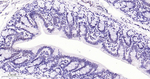 Phospho-p38 MAPK (Thr180) Antibody in Immunohistochemistry (Paraffin) (IHC (P))