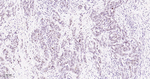Phospho-p38 MAPK (Thr180) Antibody in Immunohistochemistry (Paraffin) (IHC (P))