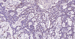Phospho-p38 MAPK (Thr180) Antibody in Immunohistochemistry (Paraffin) (IHC (P))