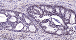 Phospho-p38 MAPK (Thr180) Antibody in Immunohistochemistry (Paraffin) (IHC (P))
