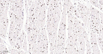 Phospho-p38 MAPK (Thr180) Antibody in Immunohistochemistry (Paraffin) (IHC (P))
