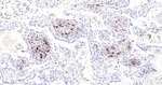 Myeloperoxidase Antibody in Immunohistochemistry (Paraffin) (IHC (P))