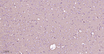 PKC alpha Antibody in Immunohistochemistry (Paraffin) (IHC (P))