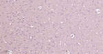 PKC alpha Antibody in Immunohistochemistry (Paraffin) (IHC (P))