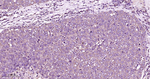 PKC alpha Recombinant Rabbit Monoclonal Antibody (9F8)