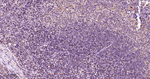 PKC alpha Antibody in Immunohistochemistry (Paraffin) (IHC (P))