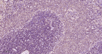 PKC alpha Antibody in Immunohistochemistry (Paraffin) (IHC (P))