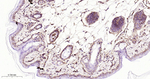 CD29 Antibody in Immunohistochemistry (Paraffin) (IHC (P))
