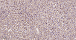 CD29 Antibody in Immunohistochemistry (Paraffin) (IHC (P))