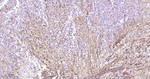 CD29 Antibody in Immunohistochemistry (Paraffin) (IHC (P))