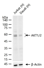AKT1/AKT2 Recombinant Rabbit Monoclonal Antibody (8F9)