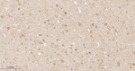 AKT1 Antibody in Immunohistochemistry (Paraffin) (IHC (P))