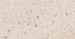 AKT1 Antibody in Immunohistochemistry (Paraffin) (IHC (P))