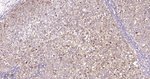 AKT1 Antibody in Immunohistochemistry (Paraffin) (IHC (P))