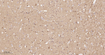 AKT1 Antibody in Immunohistochemistry (Paraffin) (IHC (P))