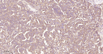 AKT1 Recombinant Mouse Monoclonal Antibody (4C4)