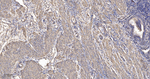 beta Actin Antibody in Immunohistochemistry (Paraffin) (IHC (P))