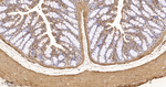 beta Actin Antibody in Immunohistochemistry (Paraffin) (IHC (P))