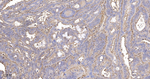 beta Actin Antibody in Immunohistochemistry (Paraffin) (IHC (P))