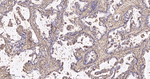 beta Actin Antibody in Immunohistochemistry (Paraffin) (IHC (P))