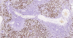 SSEA1 Antibody in Immunohistochemistry (Paraffin) (IHC (P))
