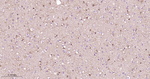 SSEA1 Antibody in Immunohistochemistry (Paraffin) (IHC (P))