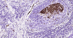 SSEA1 Antibody in Immunohistochemistry (Paraffin) (IHC (P))