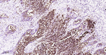 SSEA1 Antibody in Immunohistochemistry (Paraffin) (IHC (P))