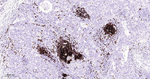 CD20 Antibody in Immunohistochemistry (Paraffin) (IHC (P))