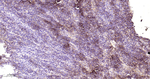 CD20 Antibody in Immunohistochemistry (Paraffin) (IHC (P))