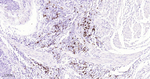 CD20 Recombinant Rabbit Monoclonal Antibody (1B9)
