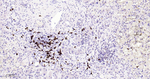 CD20 Antibody in Immunohistochemistry (Paraffin) (IHC (P))