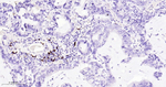 CD20 Antibody in Immunohistochemistry (Paraffin) (IHC (P))