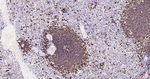 CD20 Antibody in Immunohistochemistry (Paraffin) (IHC (P))