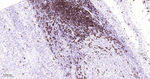 CD20 Antibody in Immunohistochemistry (Paraffin) (IHC (P))