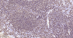 CD20 Antibody in Immunohistochemistry (Paraffin) (IHC (P))