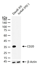 CD20 Antibody in Western Blot (WB)