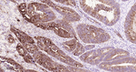 SQSTM1 Antibody in Immunohistochemistry (Paraffin) (IHC (P))