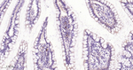SQSTM1 Recombinant Rabbit Monoclonal Antibody (4B8)