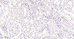 SQSTM1 Antibody in Immunohistochemistry (Paraffin) (IHC (P))